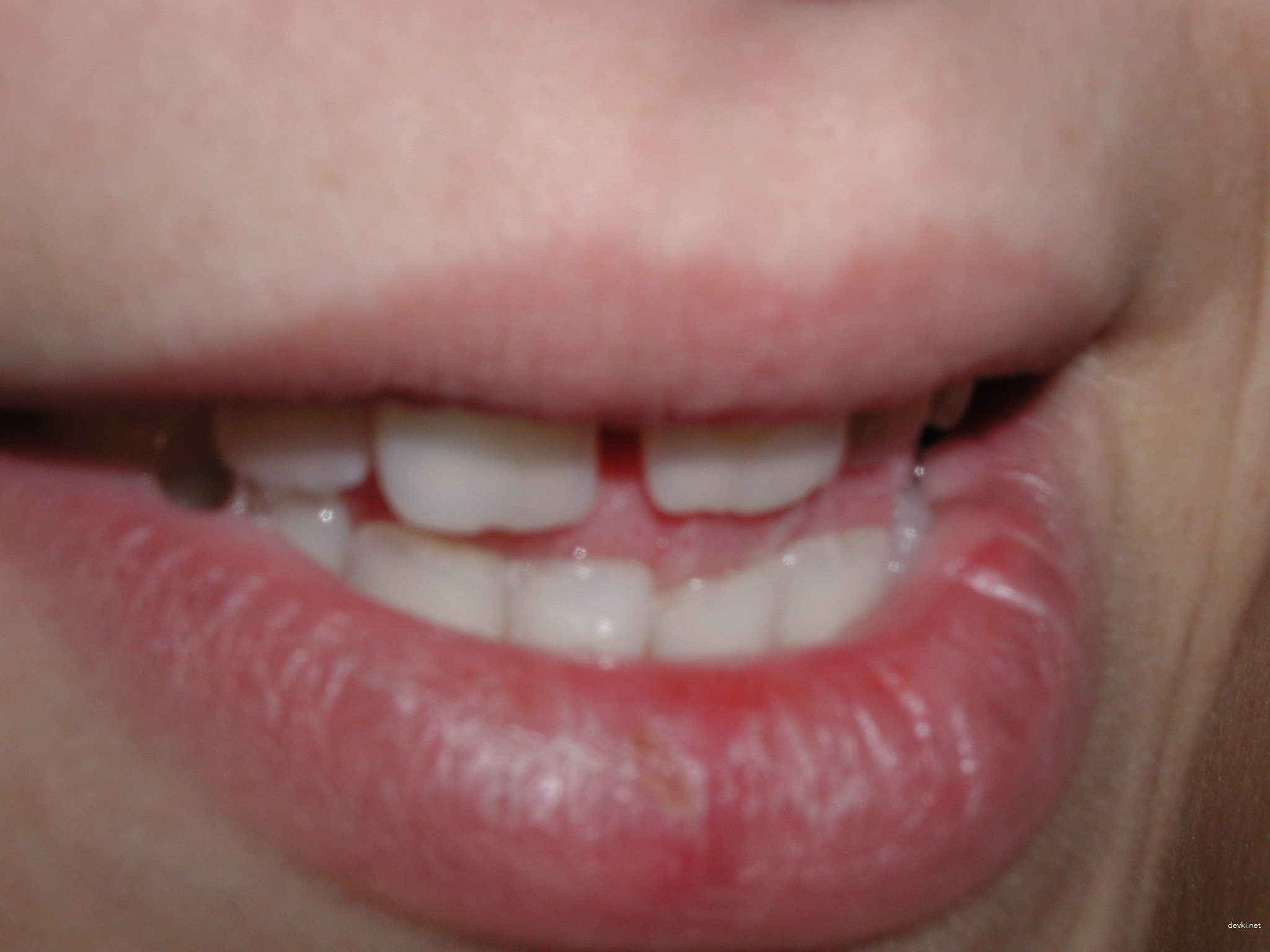 Amateur Athlete Porn Photos: Sexy Sportswoman in Explicit Action