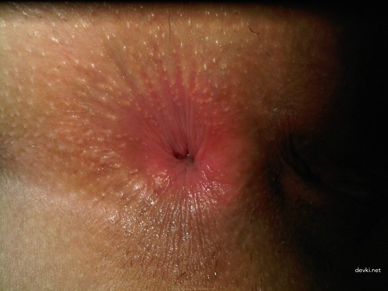 Boyfriend admires girlfriend's pussy and ass in amateur porn photo