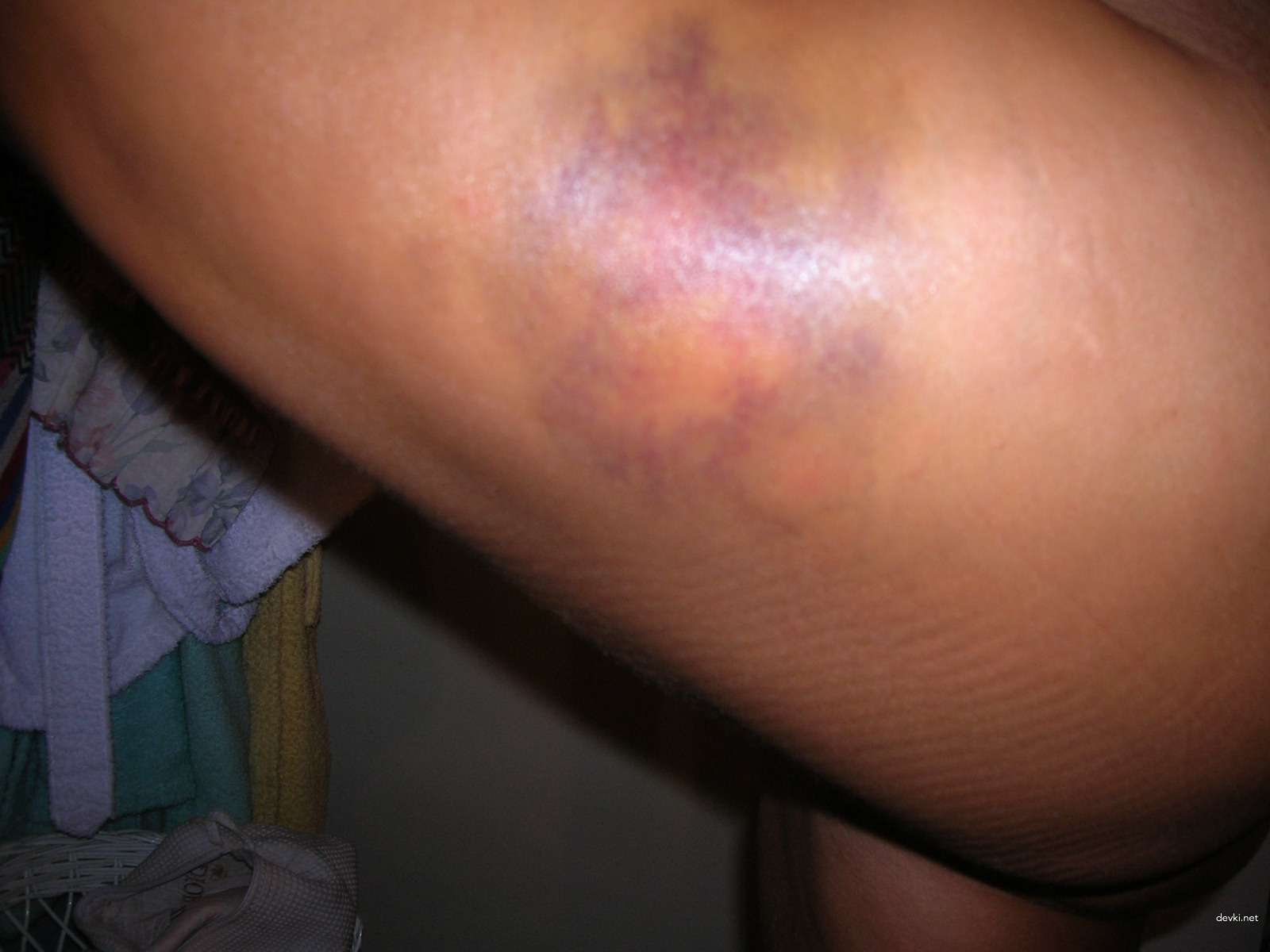 Explicit Amateur Porn Photos of Sexy Woman - Hot XXX Pics