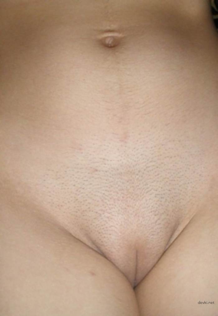 Young Babe with Shaved Bush: Explicit Amateur Photo