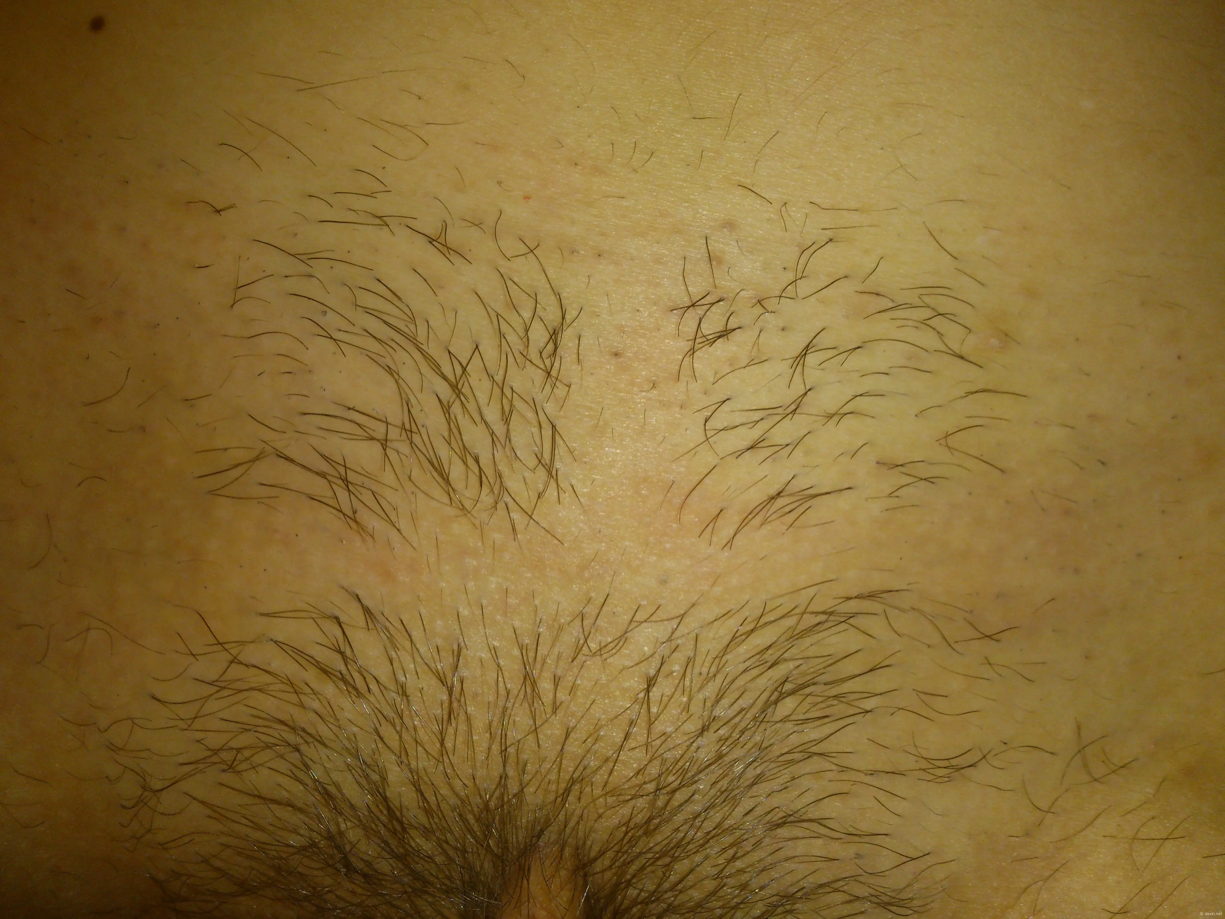 Explicit Amateur Nude Emotions: XXX Photos