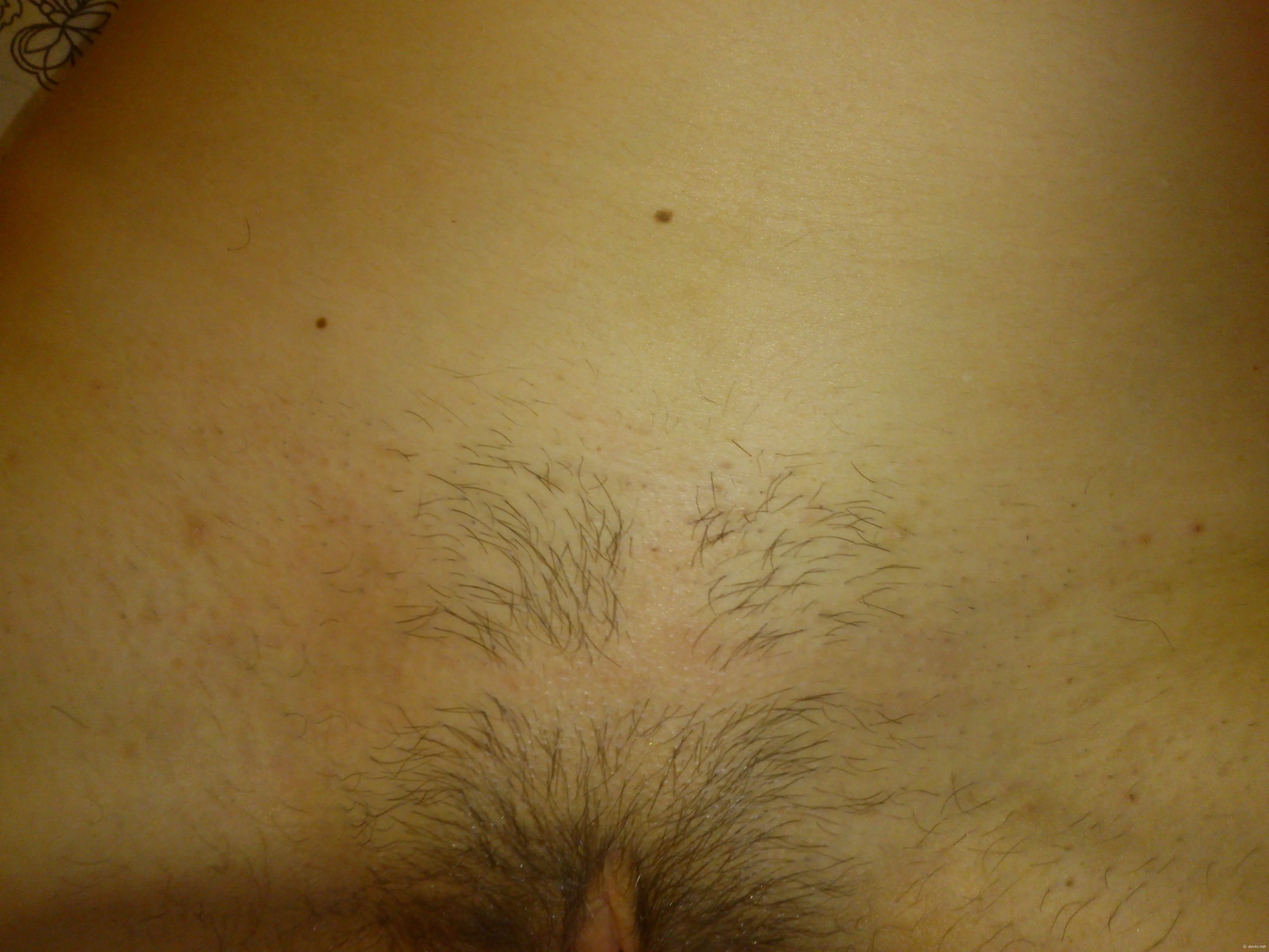 Explicit Amateur Nude Emotions: XXX Photos